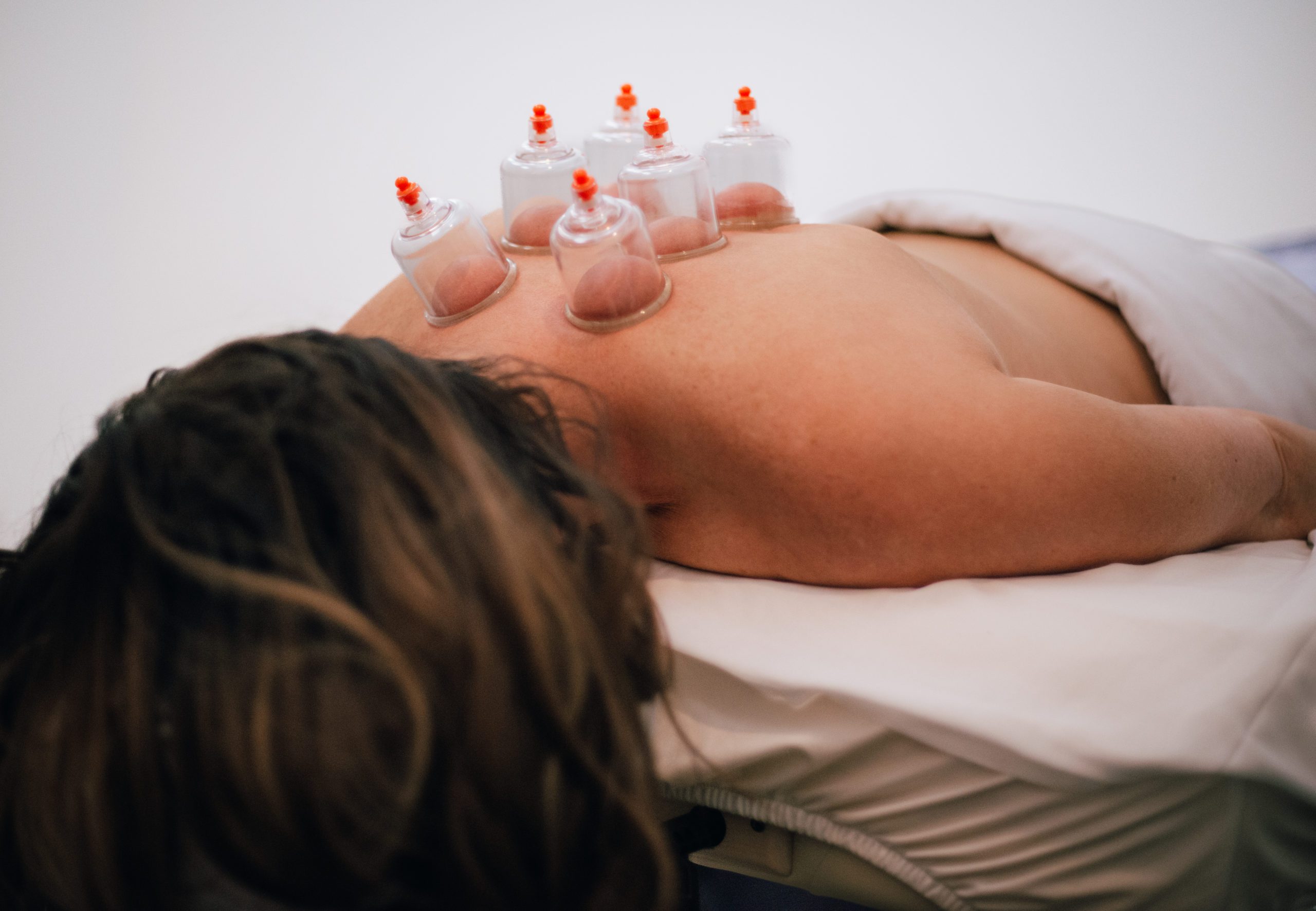 Cupping Massage on a woman